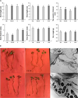 Bacillus cereus Enhanced Medicinal Ingredient Biosynthesis in Glycyrrhiza uralensis Fisch. Under Different Conditions Based on the Transcriptome and Polymerase Chain Reaction Analysis